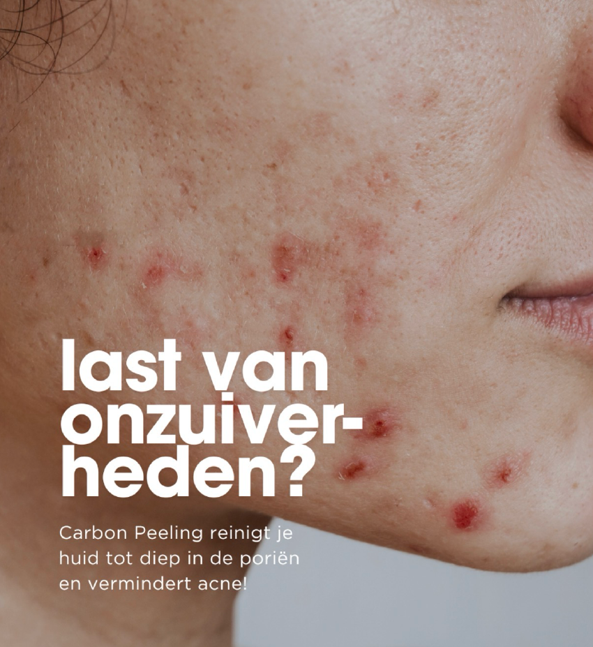 last van onzuiverheden?